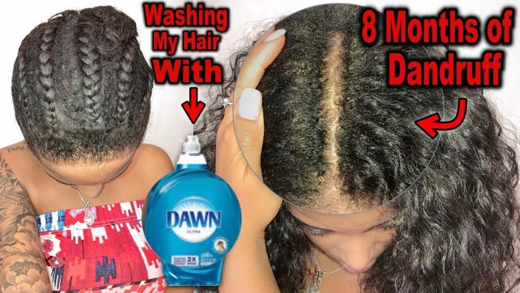 Can You Use Dawn Dish Soap on Your Hair