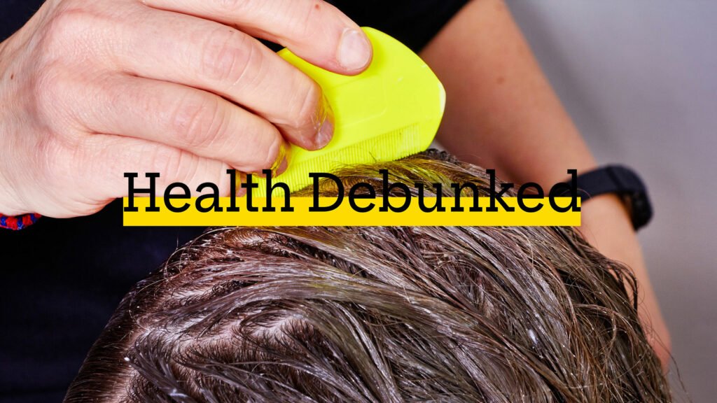 Does Hair Dye Kill Lice And Nits? Here'S the Truth!