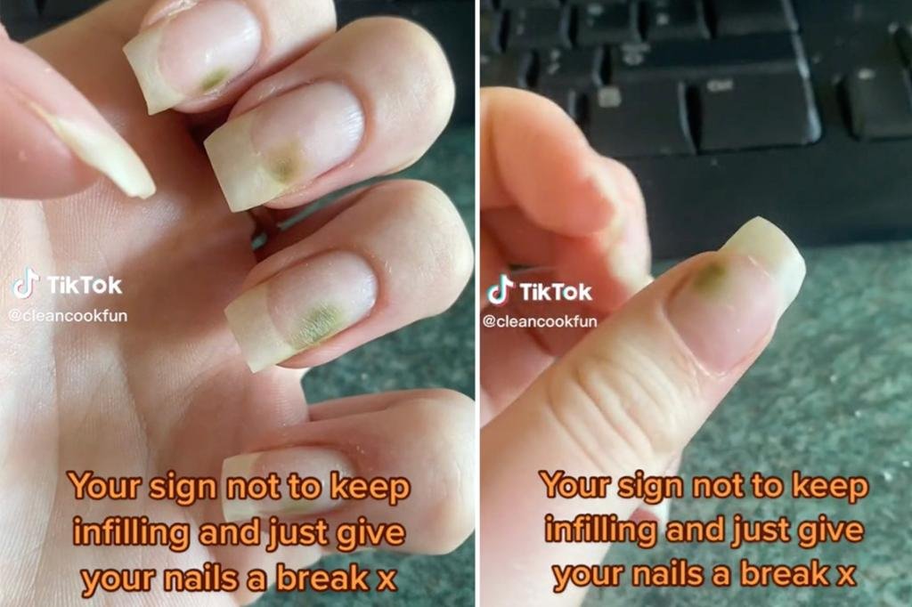 How to Get Rid of Green Nails After False Nails