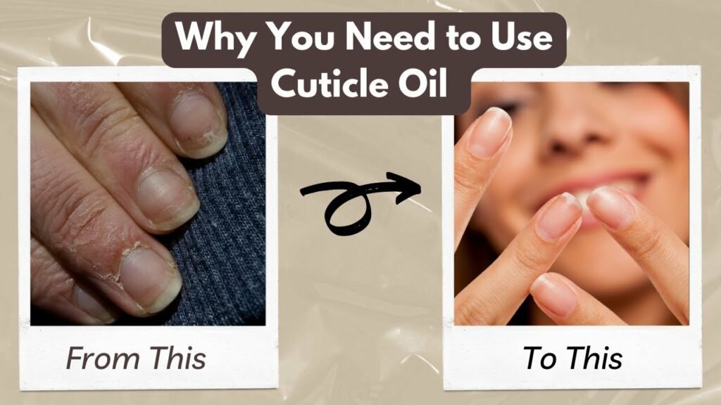 What are the Benefits of Using Cuticle Oil