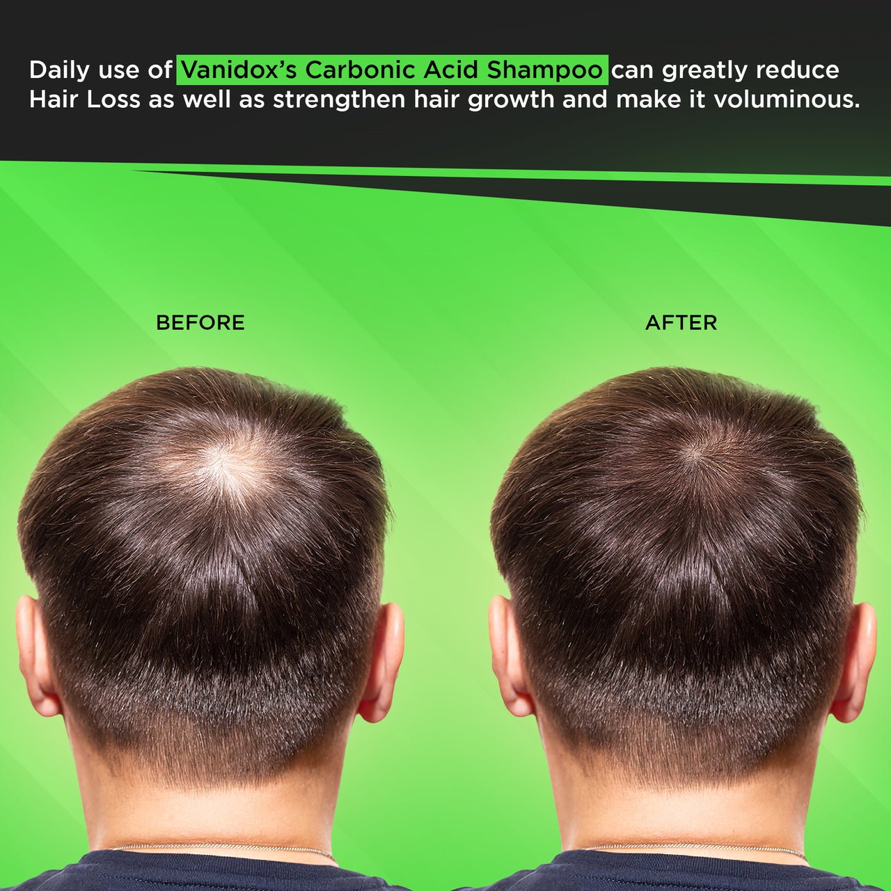 Why is Carbonic Acid Shampoo Bad for You
